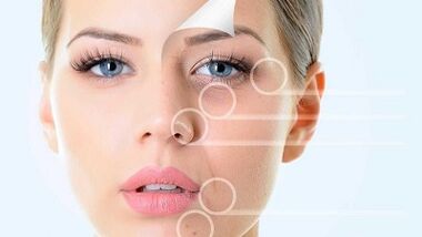 Face rejuvenation