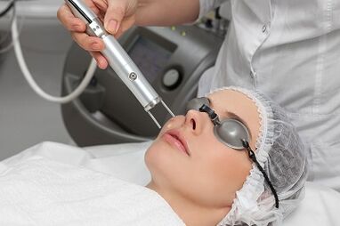 benefits of laser rejuvenation